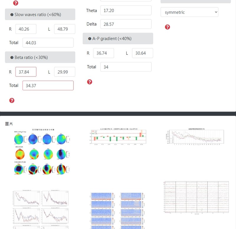 AI / EEG 分析
