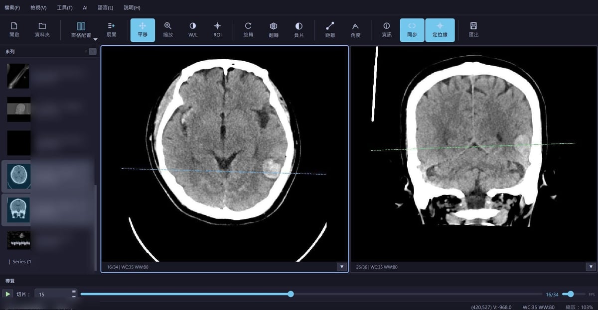 DICOM Viewer 醫學影像瀏覽器