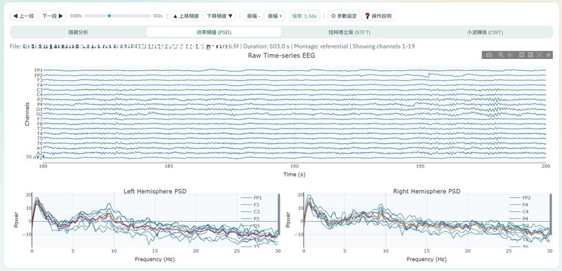 Web EEG 腦波瀏覽平台